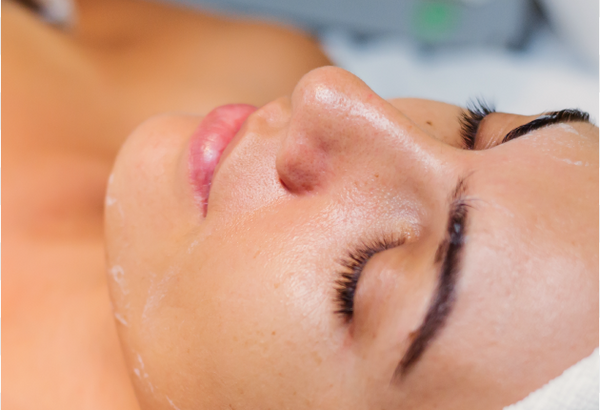 Laser Hair Removal